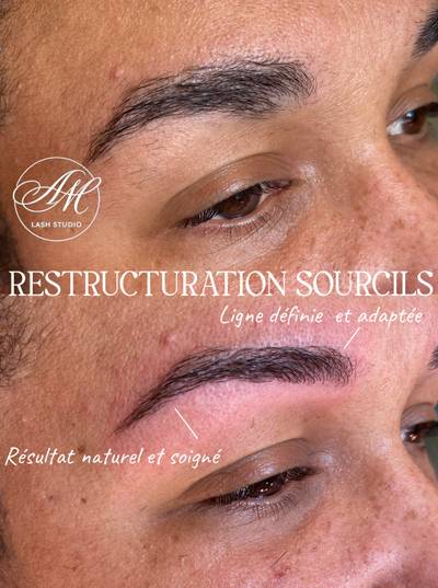 Restructuration sourcils